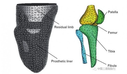 增材制造技術 假肢與矯形器領域的個性化革新